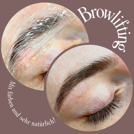 Referenzbild Referenzbild, Frau, Browlifting