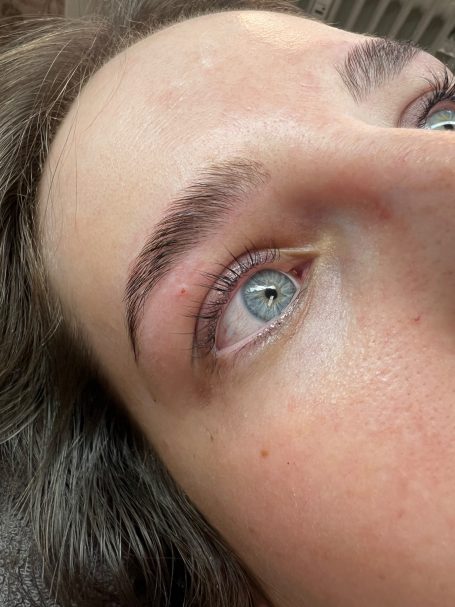 Referenzbild Testemonial-Foto, Frau nach Augenbrauen.- Browlifting